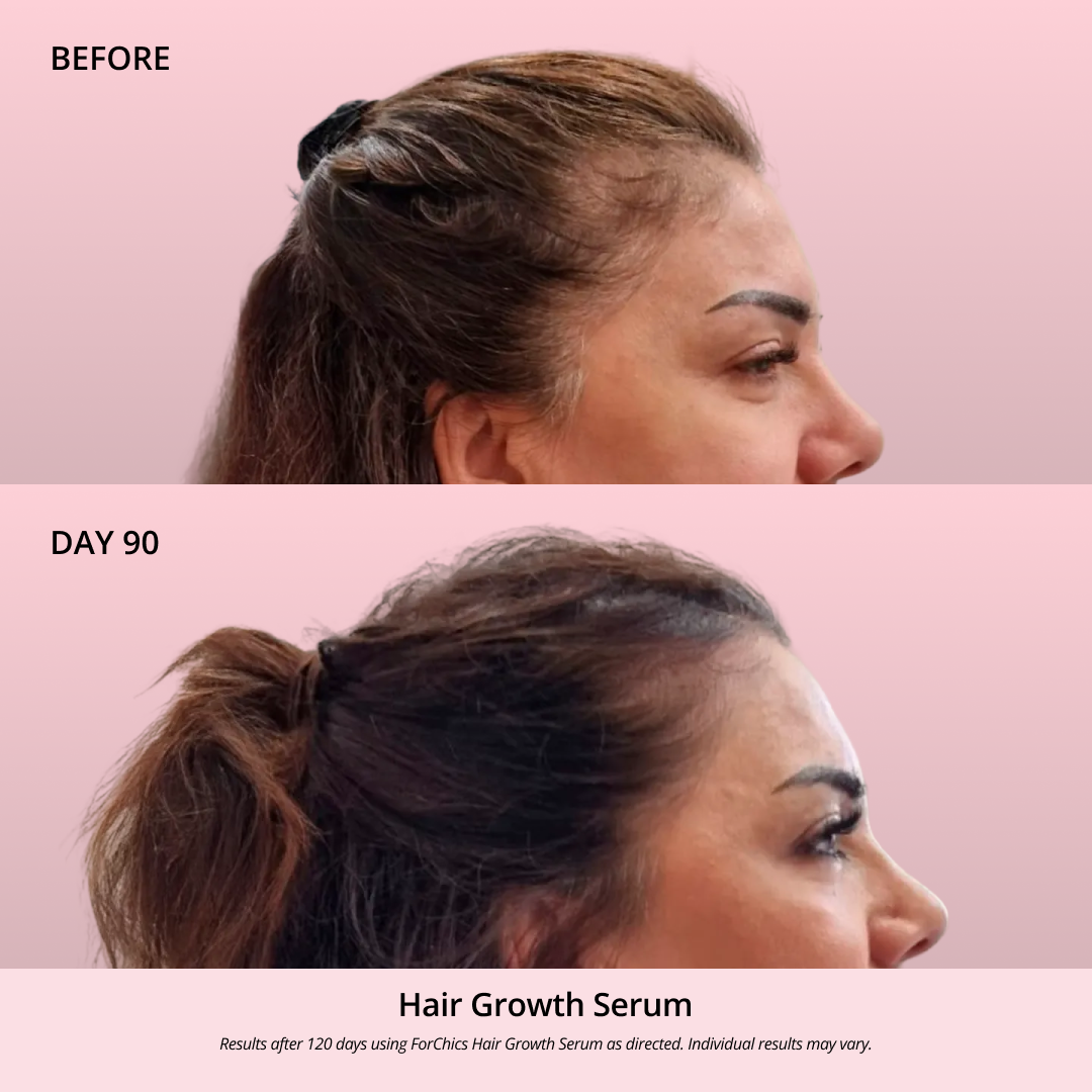 Spray de Aceite para el Crecimiento del Cabello
