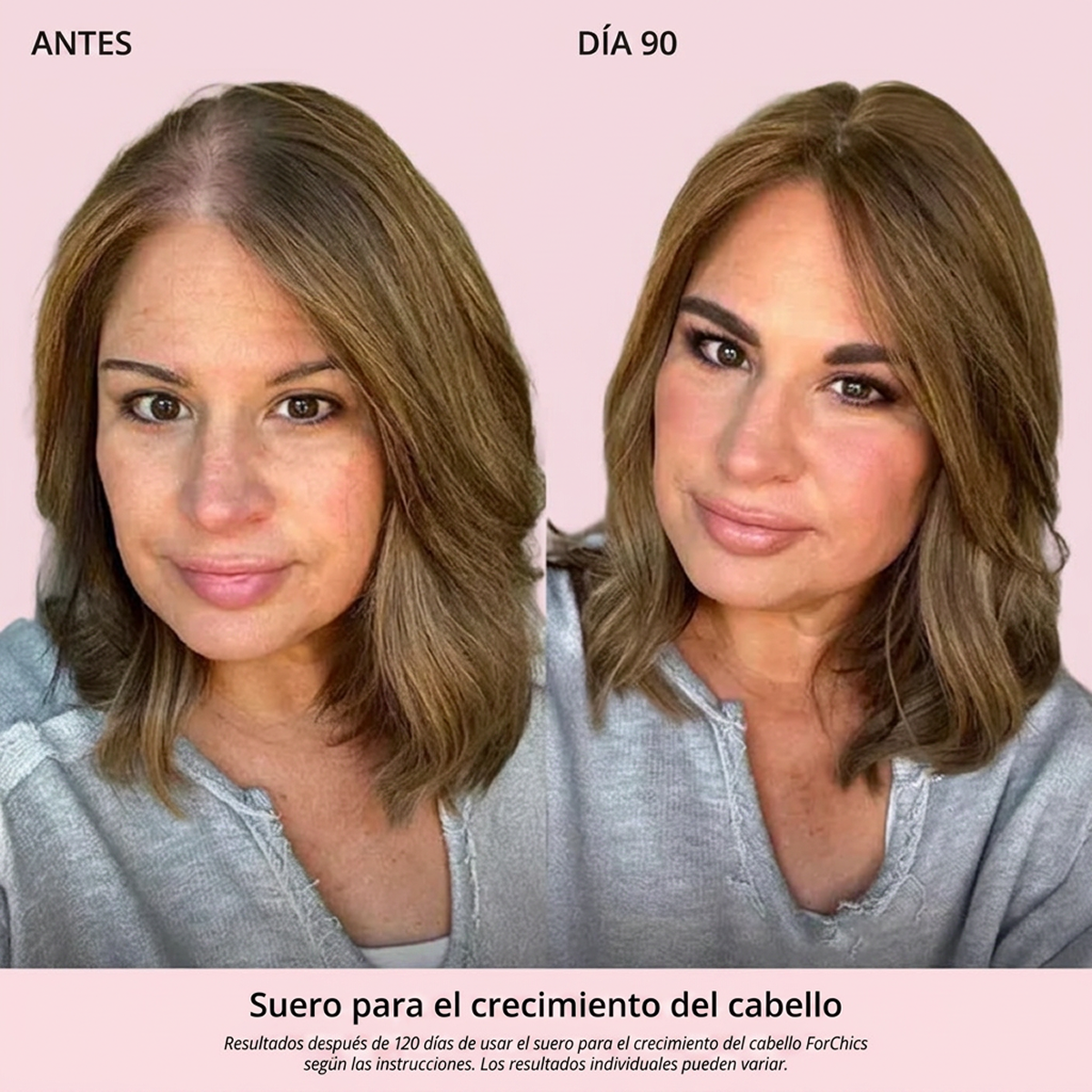 Spray de Aceite para el Crecimiento del Cabello