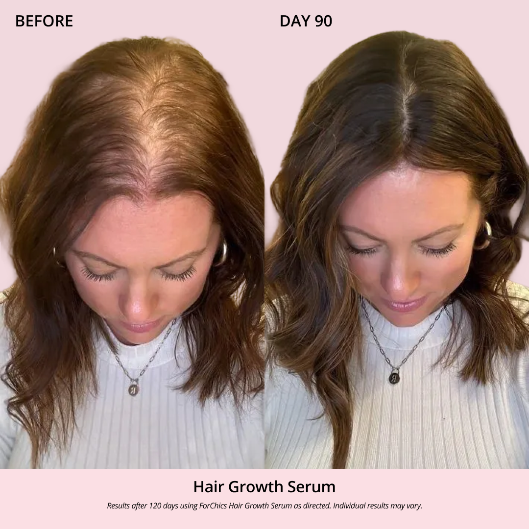 Spray de Aceite para el Crecimiento del Cabello