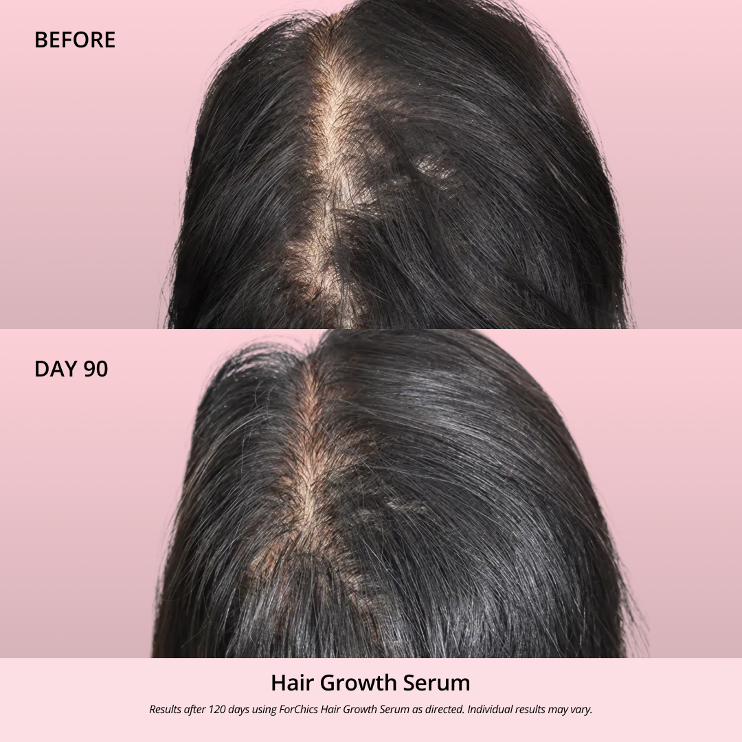 Spray de Aceite para el Crecimiento del Cabello
