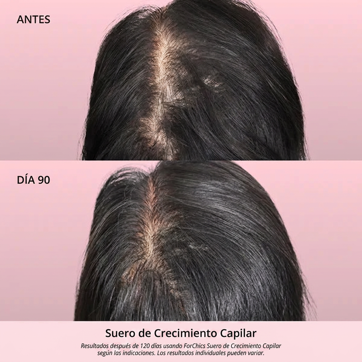 Spray de Aceite para el Crecimiento del Cabello