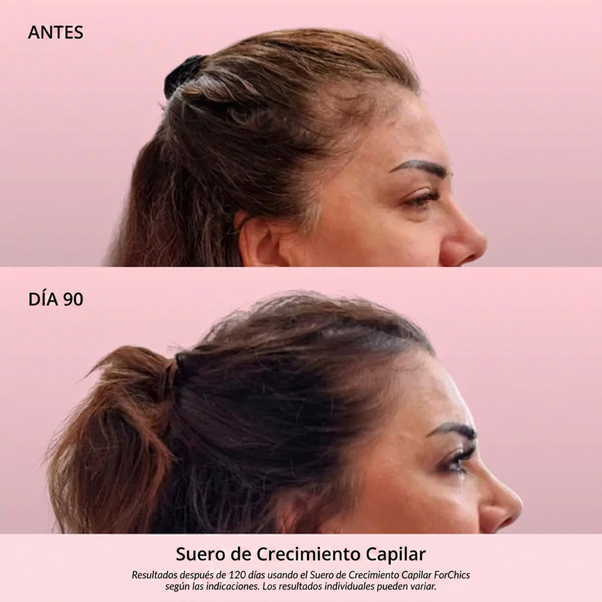 Spray de Aceite para el Crecimiento del Cabello