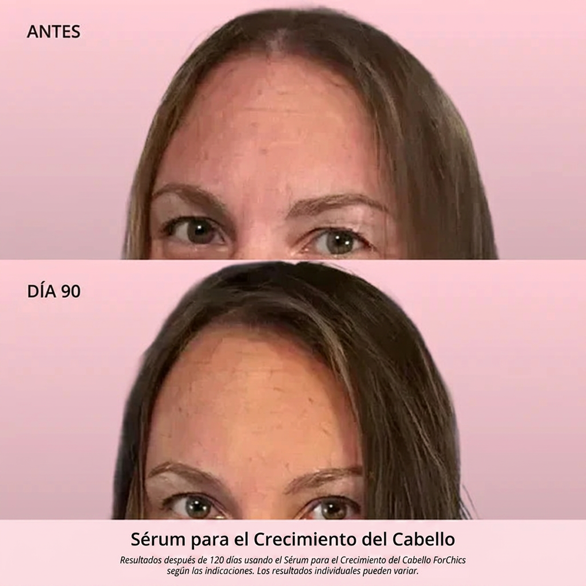 Spray de Aceite para el Crecimiento del Cabello