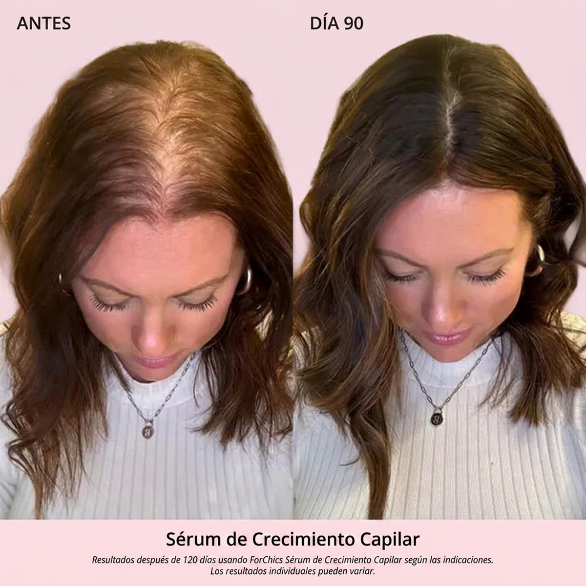 Spray de Aceite para el Crecimiento del Cabello
