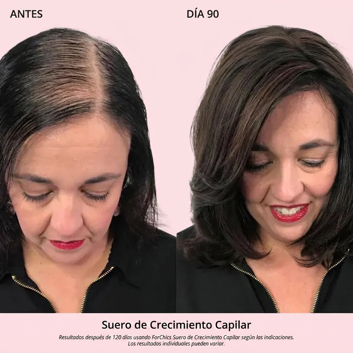 Spray de Aceite para el Crecimiento del Cabello