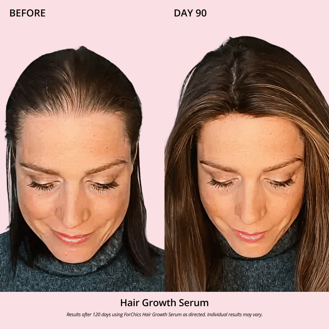 Spray de Aceite para el Crecimiento del Cabello