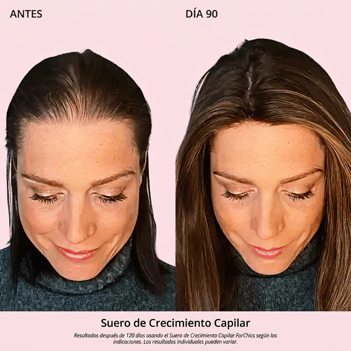Spray de Aceite para el Crecimiento del Cabello