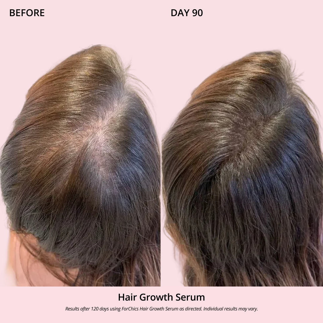 Spray de Aceite para el Crecimiento del Cabello