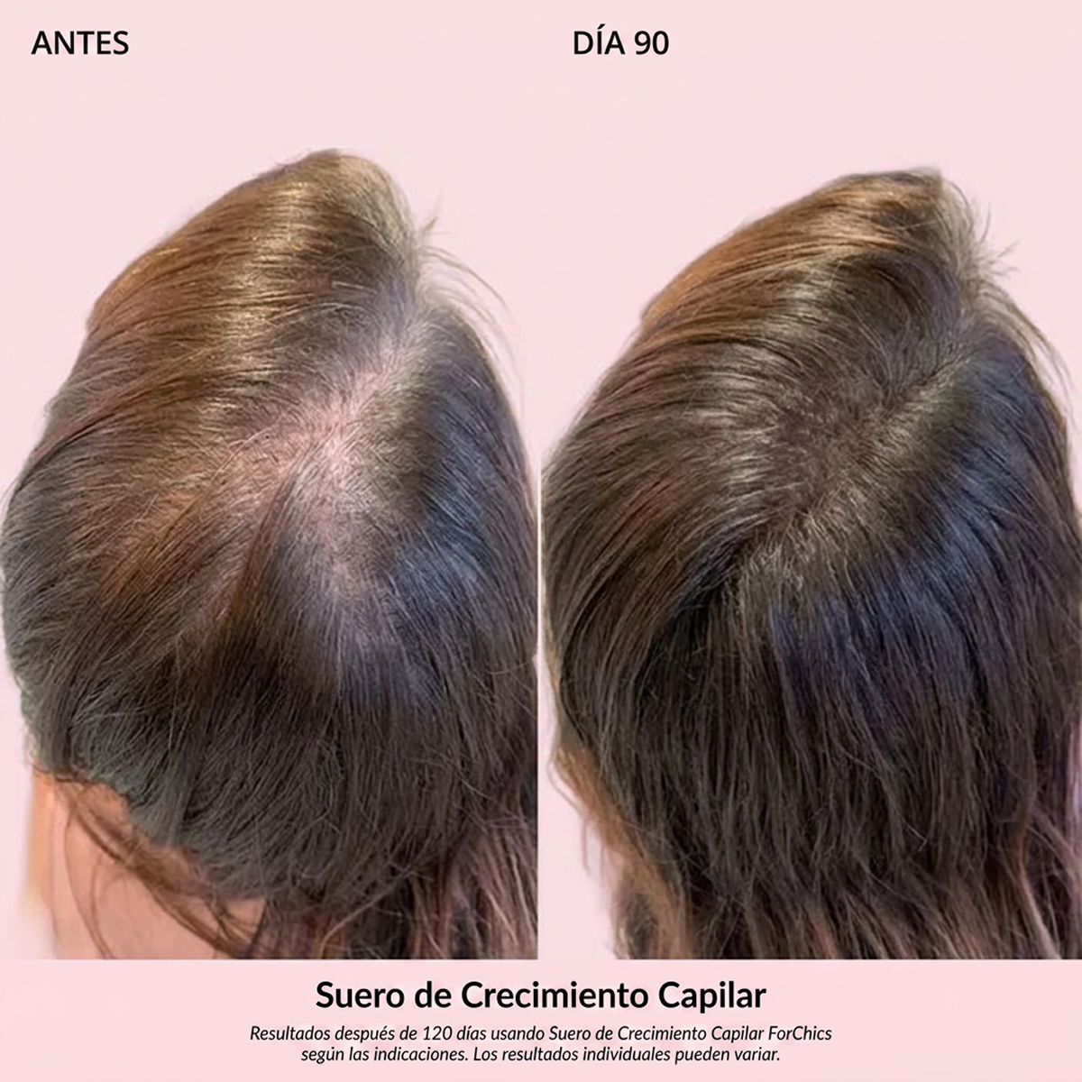 Spray de Aceite para el Crecimiento del Cabello