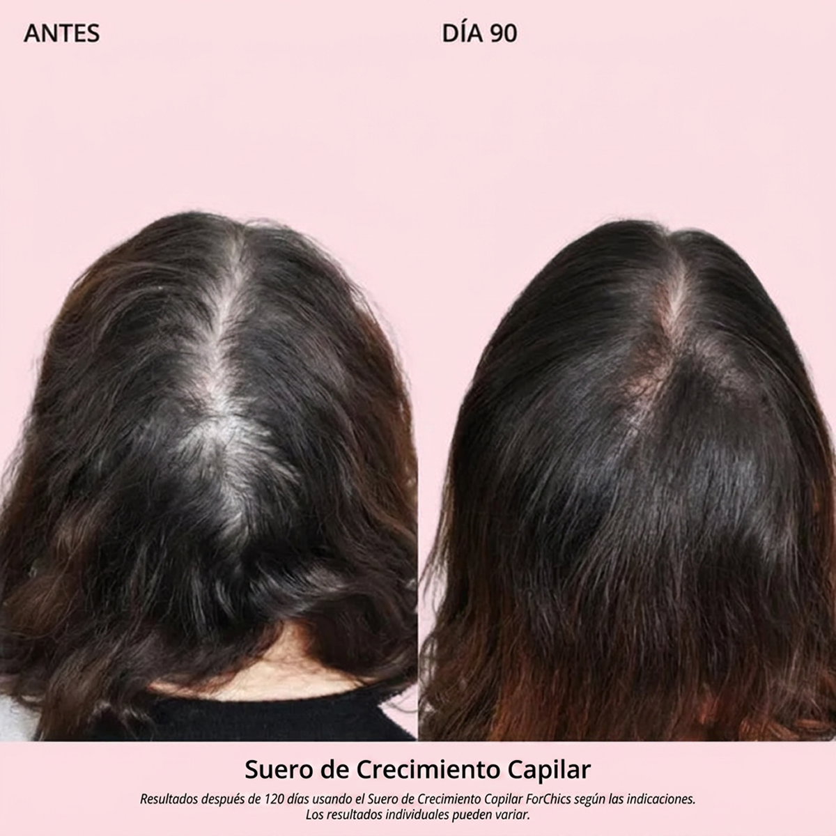 Spray de Aceite para el Crecimiento del Cabello