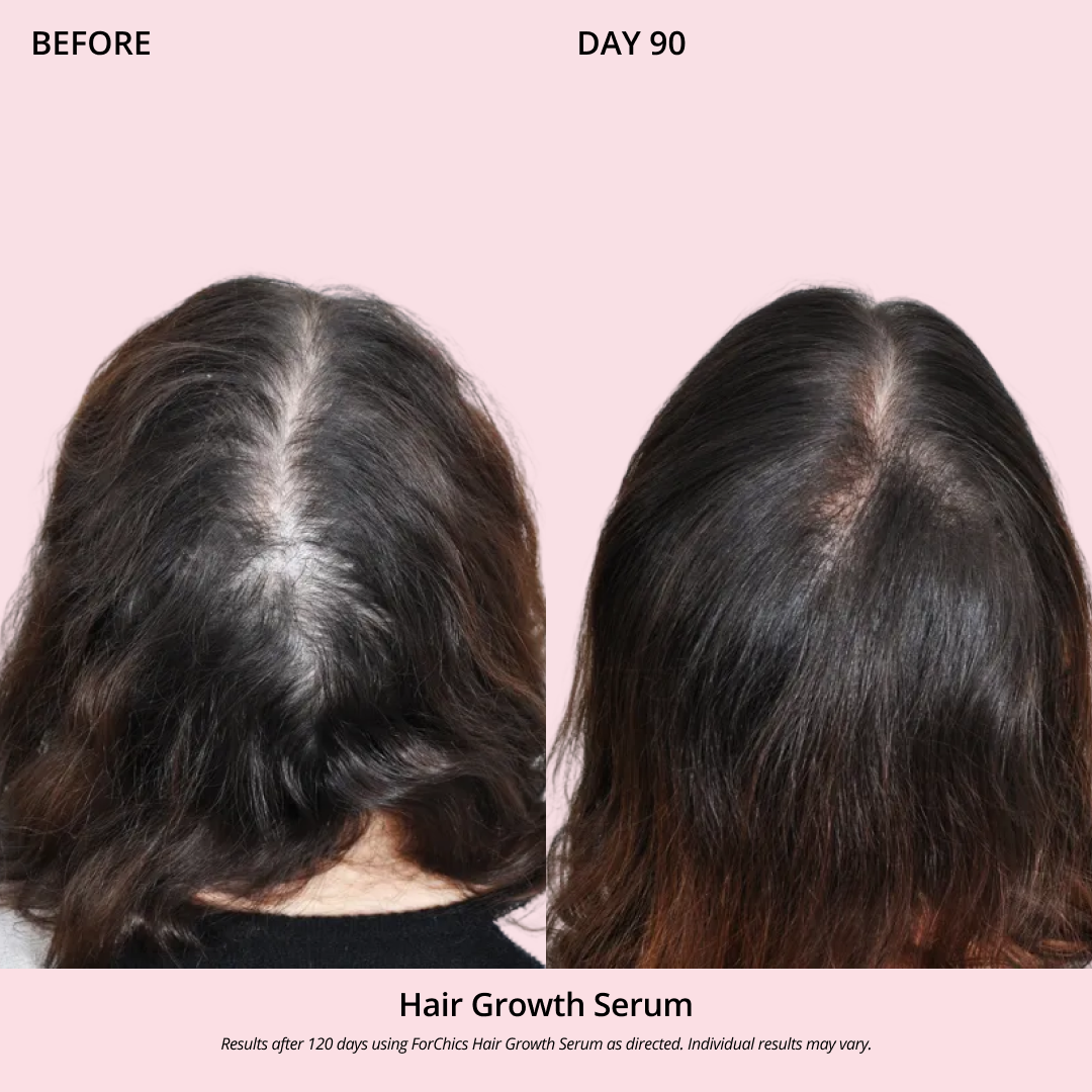 Spray de Aceite para el Crecimiento del Cabello